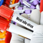 West Nile virus in Italia: 84 casi confermati, due decessi da febbraio